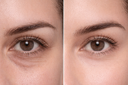 Collageen oog patches